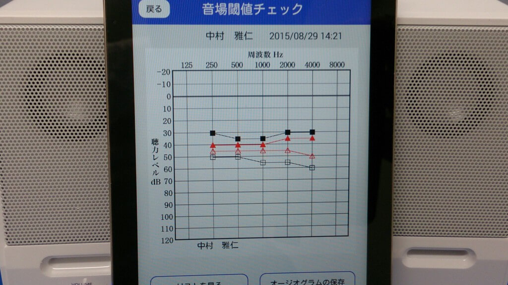 補聴器購入後に調整の重要性を知る