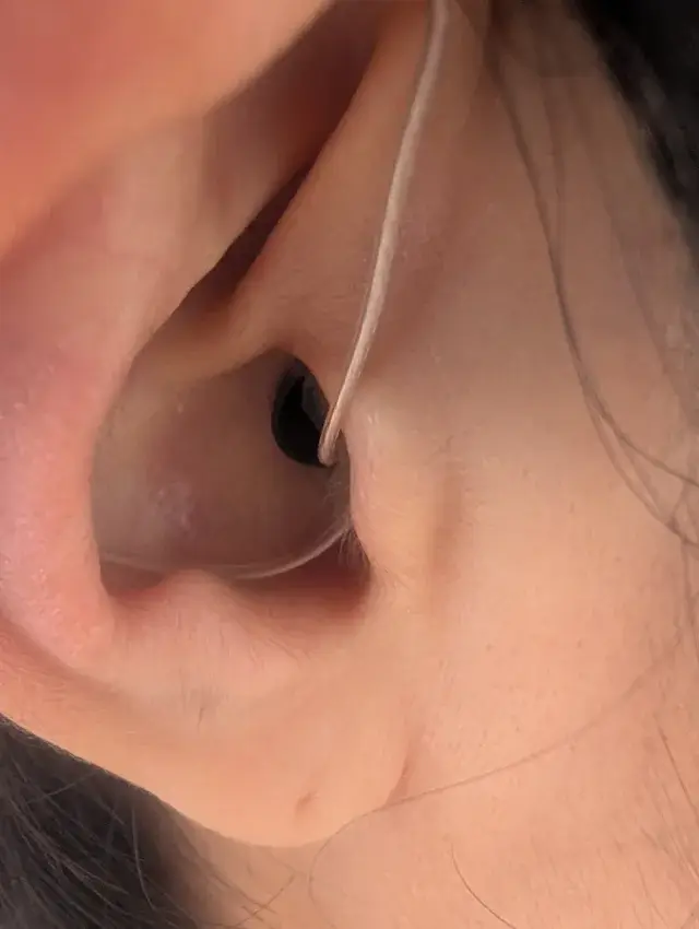 装着部分を見直した後の耳の中の様子