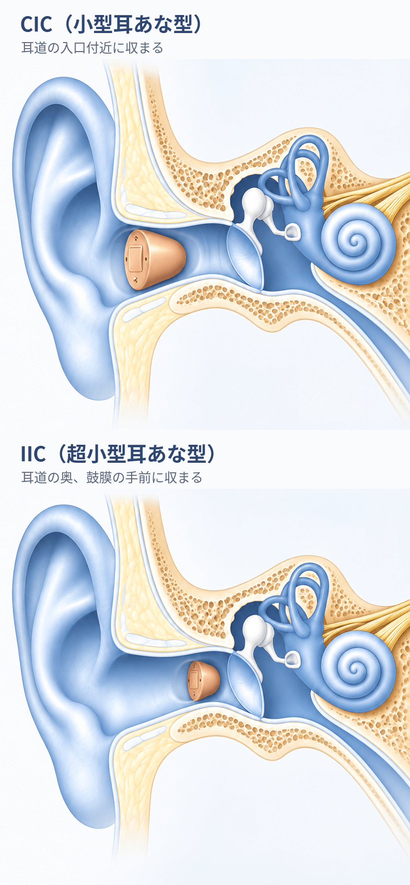 CIC（小型耳あな型）とIIC（超小型耳あな型）の耳道内での位置の違い