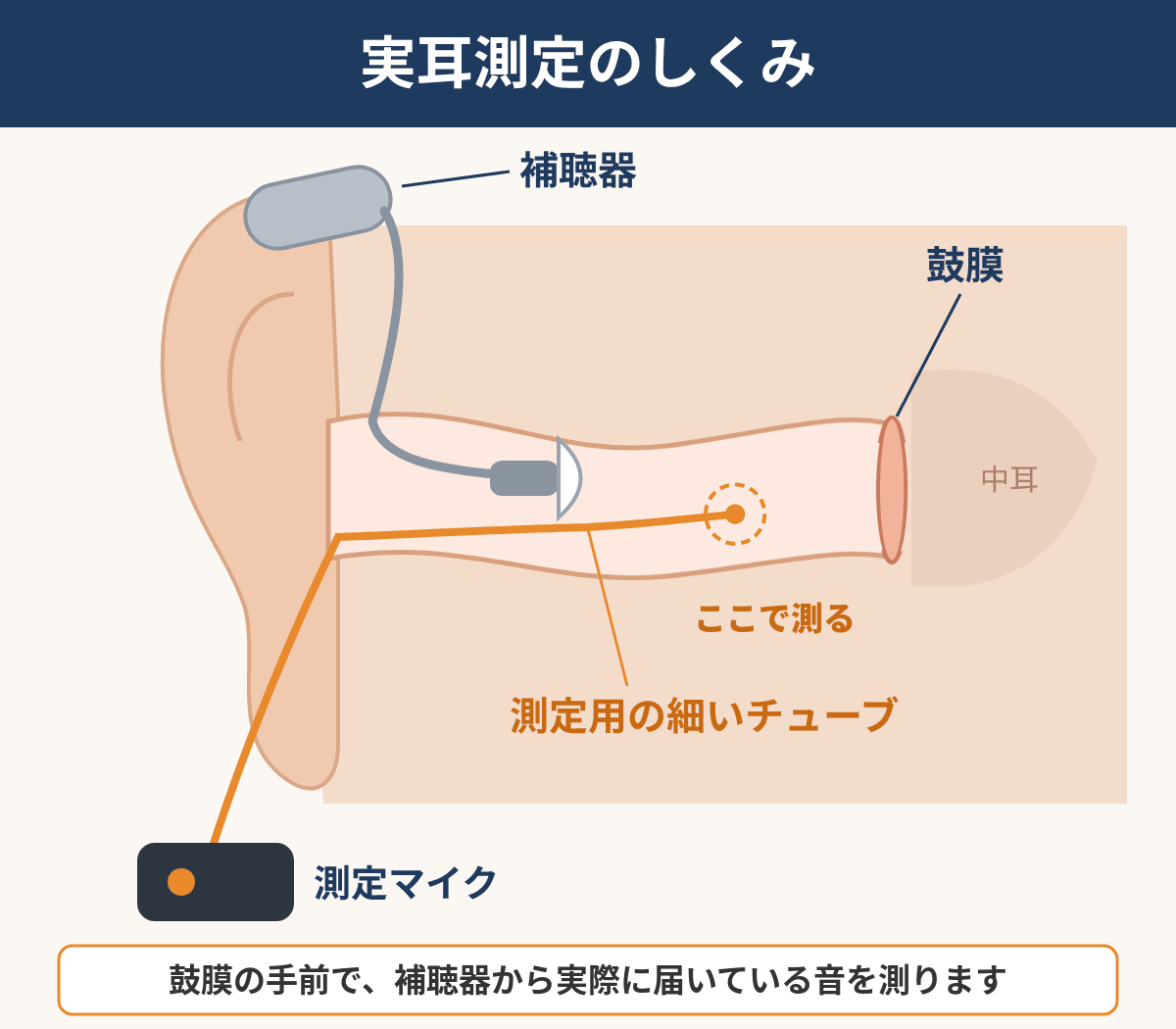 実耳測定（REM）の仕組み。耳の中に細いチューブを入れ、補聴器から出た音を鼓膜の近くで測る